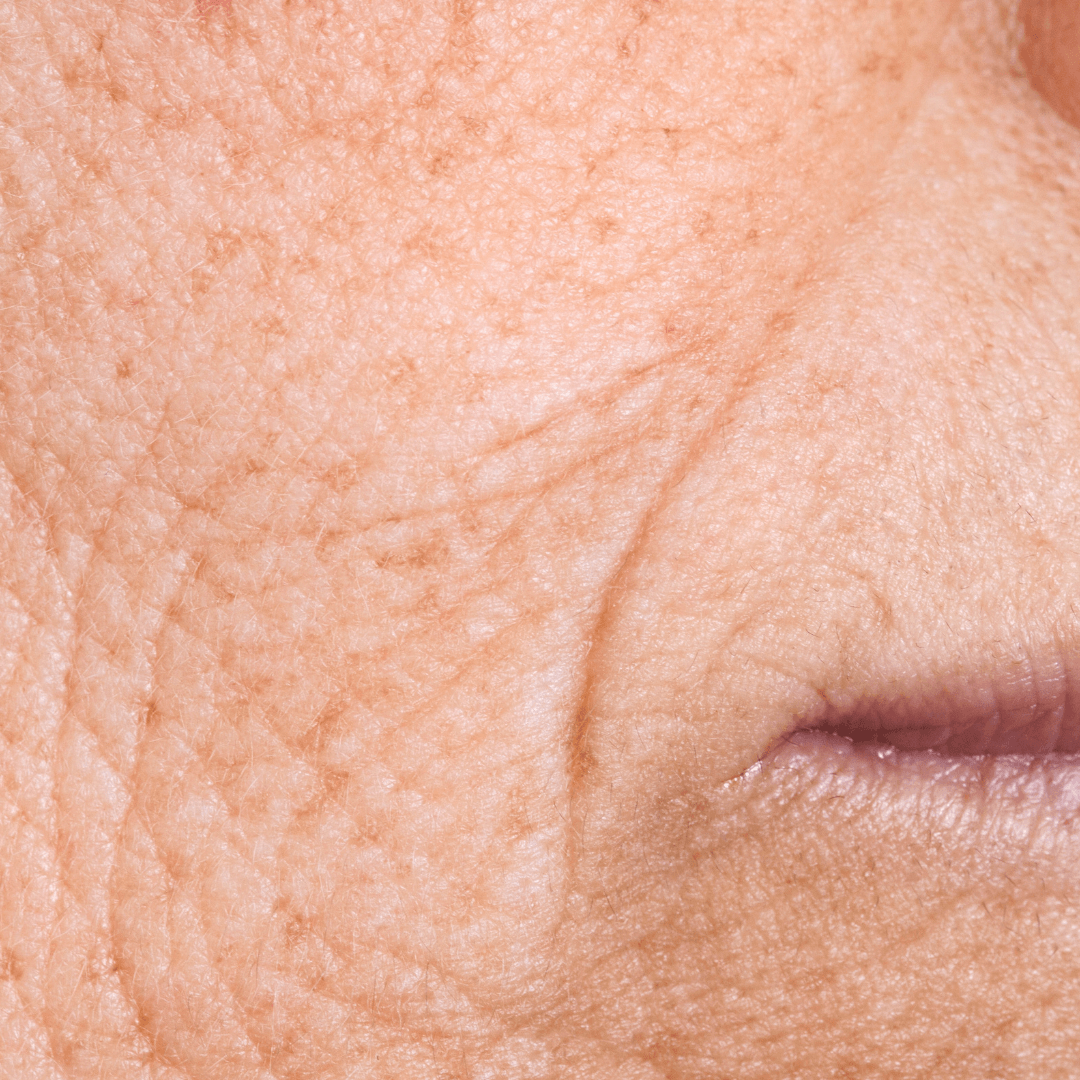 Pourquoi ta peau vieillit plus vite que tu ne le penses (pollution, stress, écrans)